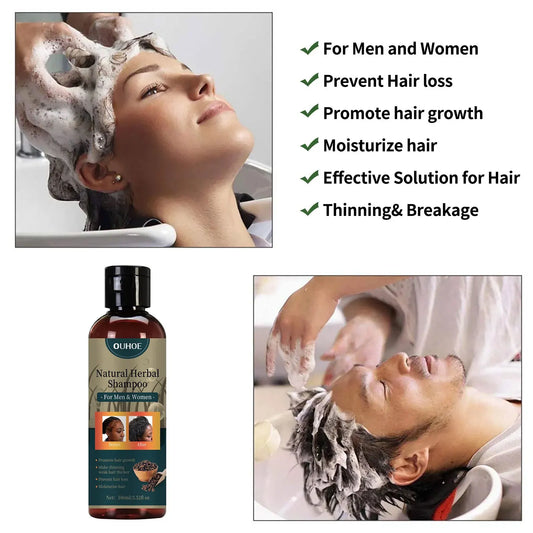 OUHOE Hair Growth Shampoo Dandruff Removal Thinning Alopecia Treatment Oil Control Nourishing Strengthen Anti Hair Loss Shampoo