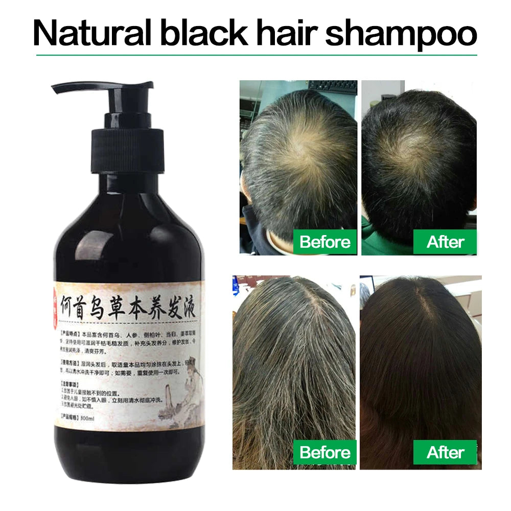 Herbal Natural Polygonum Multiflorum Shampoo Plant  Liquid Grey Hair  White Hair Removal Turn Permanent Black Hair Care 300ml