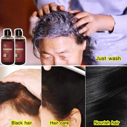 300mL Herbal Shampoo Polygonum multiflorum white to black shampoo Effective Grey Hair Remover Anti White Hair Treatmen