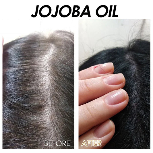 Jojoba Oil Hair Tightening Solution Prevents Hair Loss Repairs Dry And Angry Hair Softening Conditioning Oil For Tightening Hair