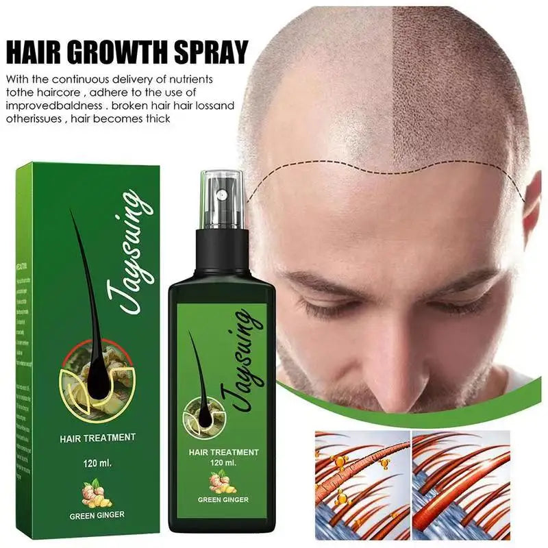 Fast Ginger Hair Growth Spray Roots Grow Anti Hair Loss Serum Liquid Scalp Damaged Treatment Repair Care Products Beauty Health